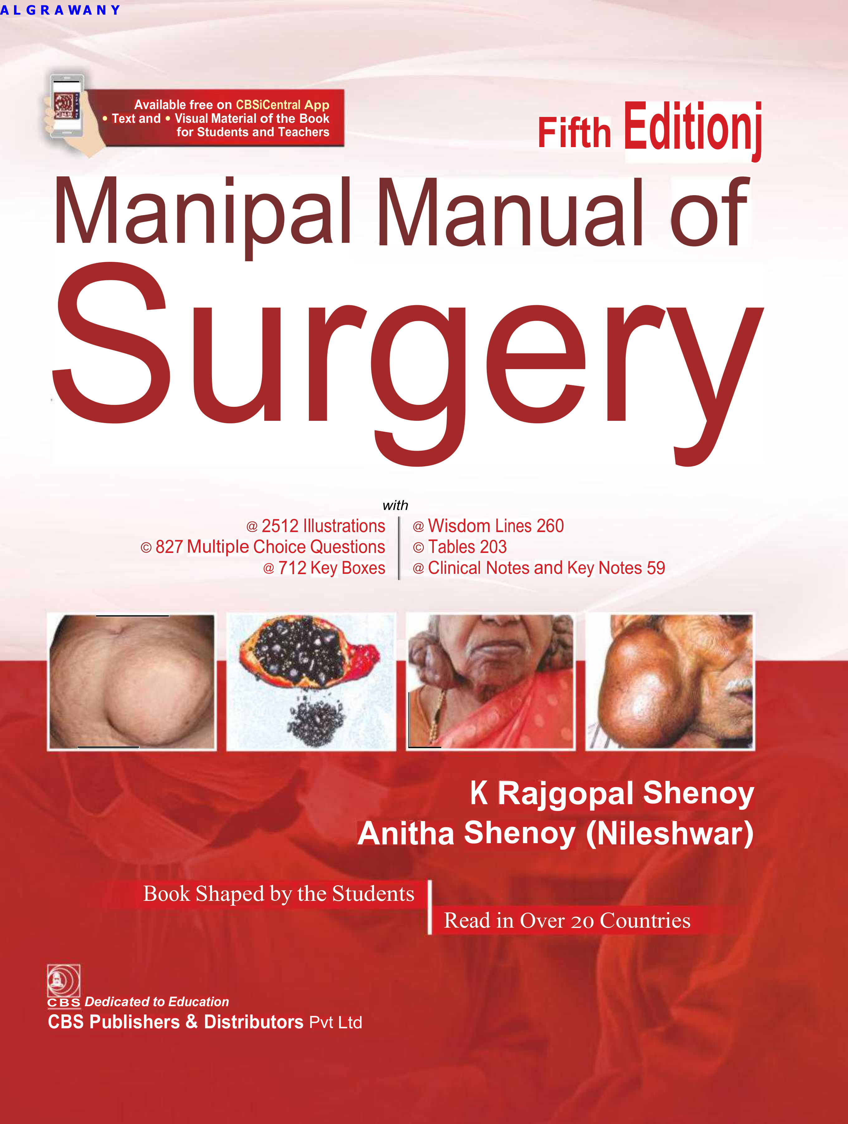 Manipal Manual of Surgery
