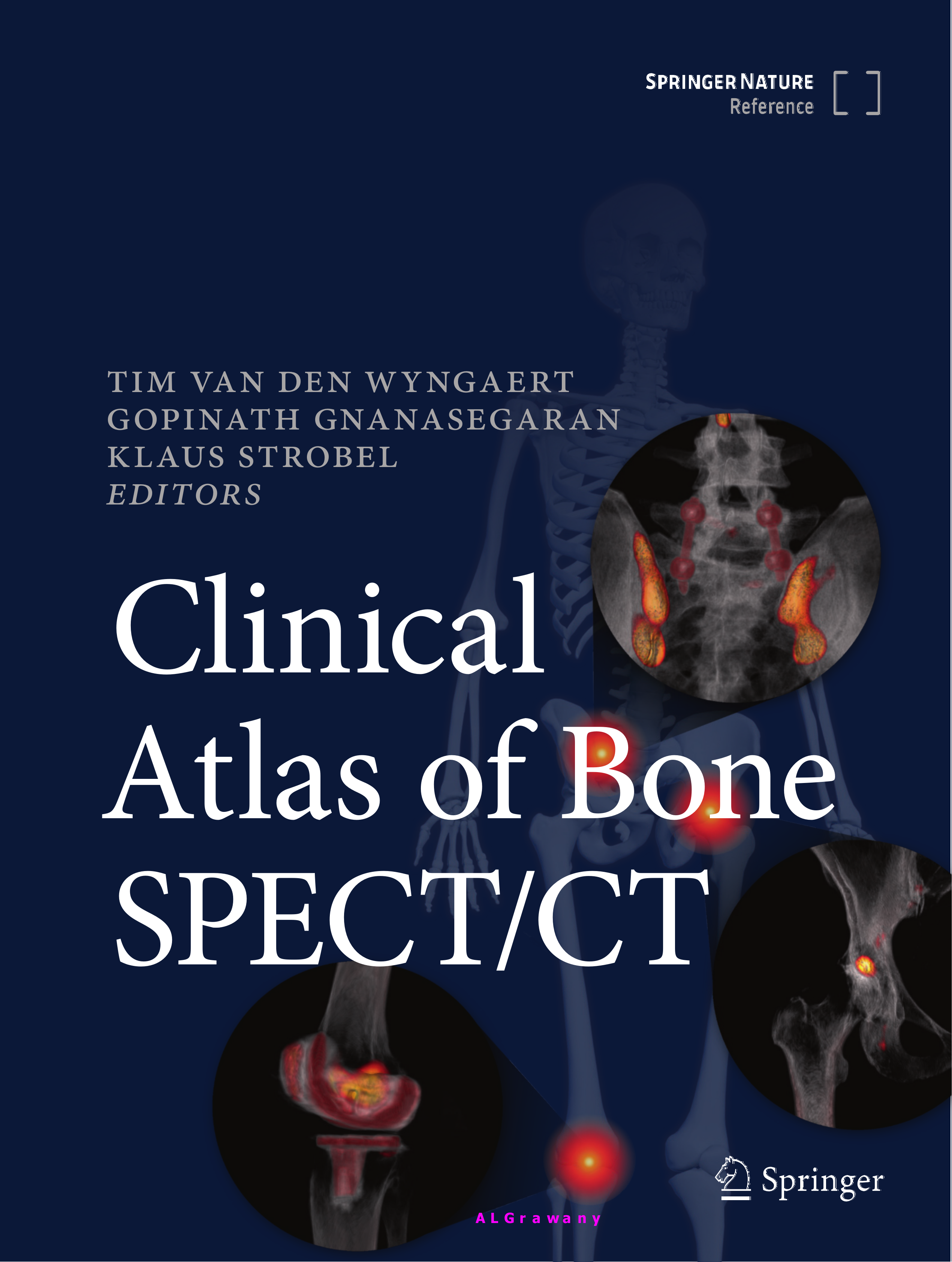 Clinical Atlas of Bone SPECT/CT