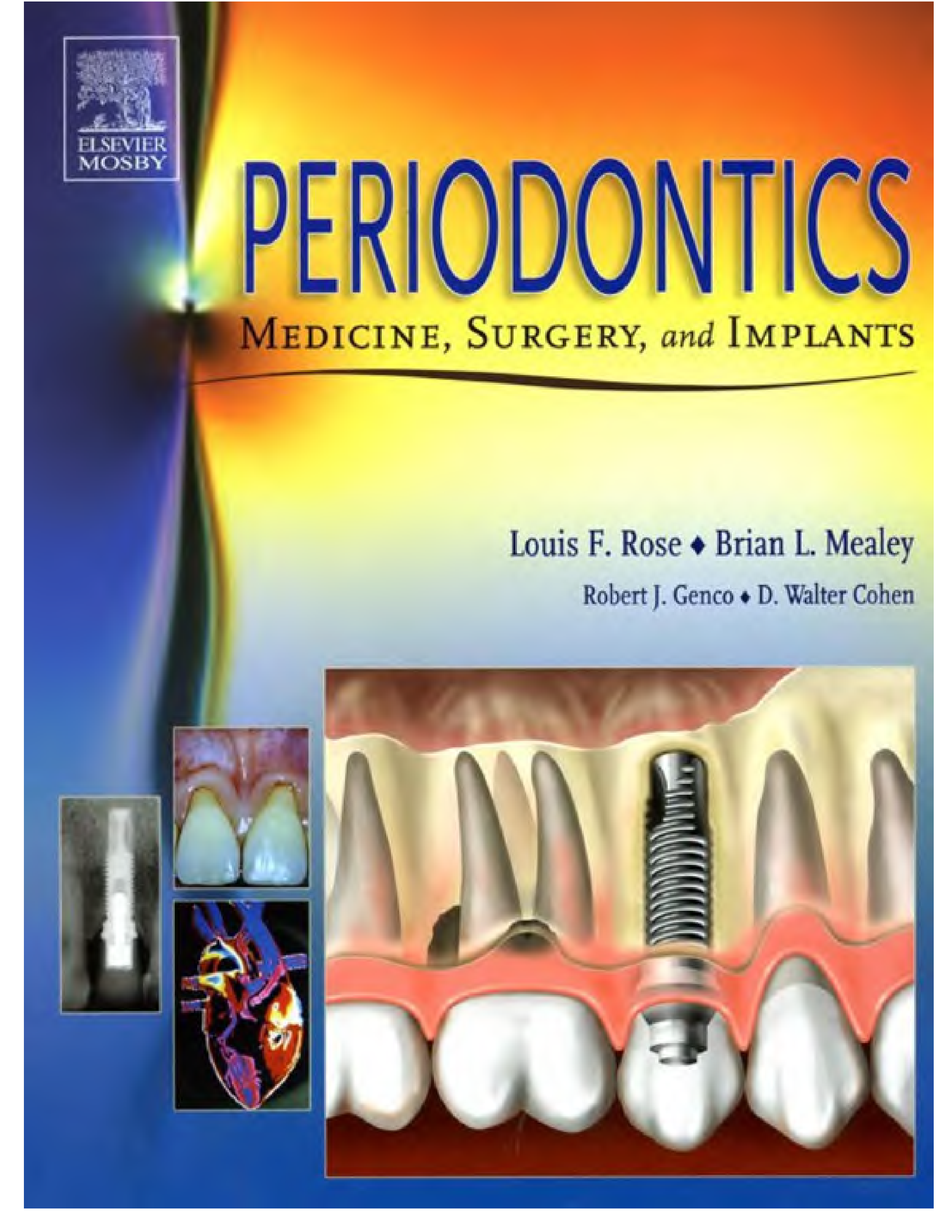 Periodontics