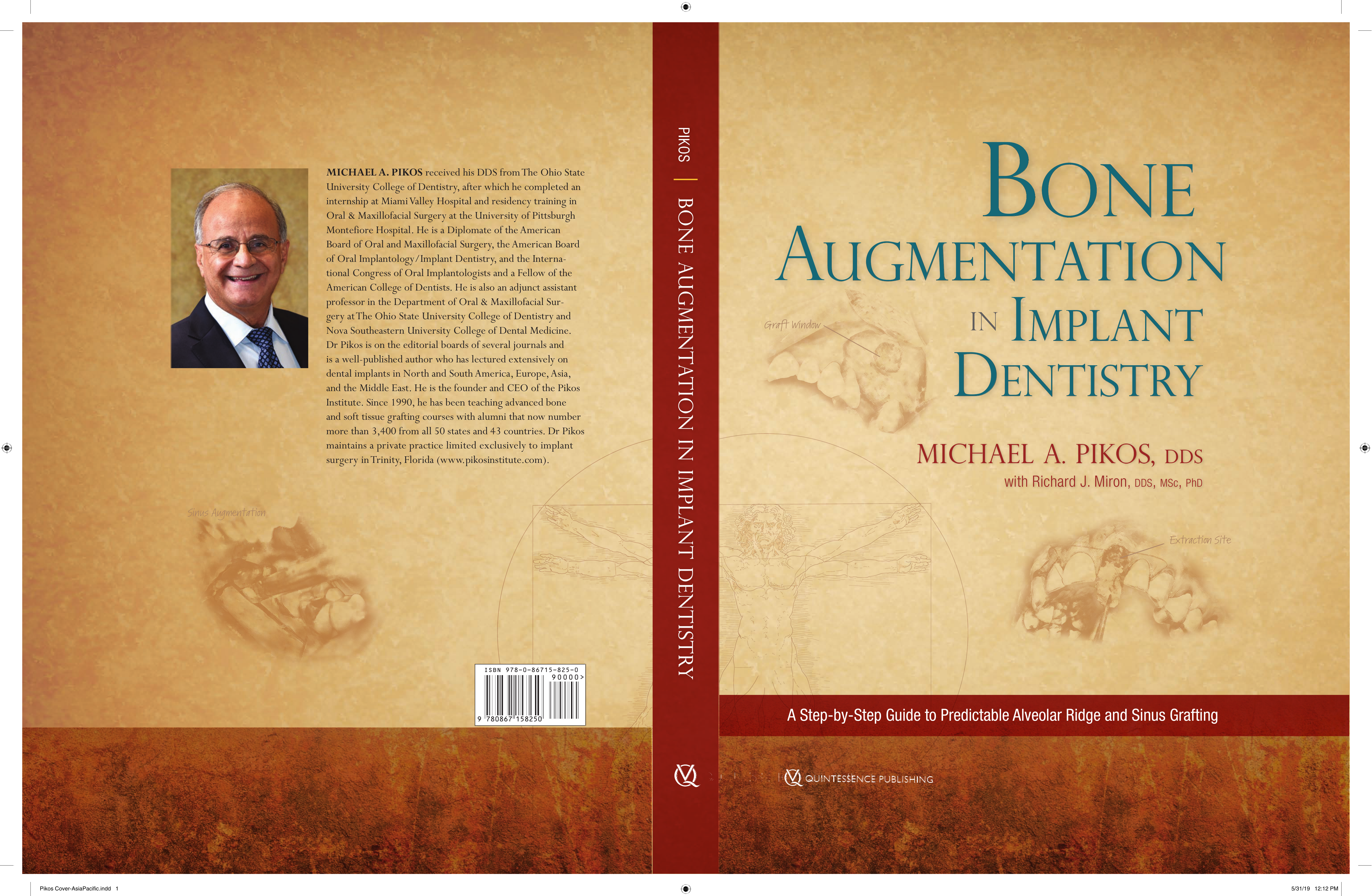 Bone Augmentation in Oral Implantology