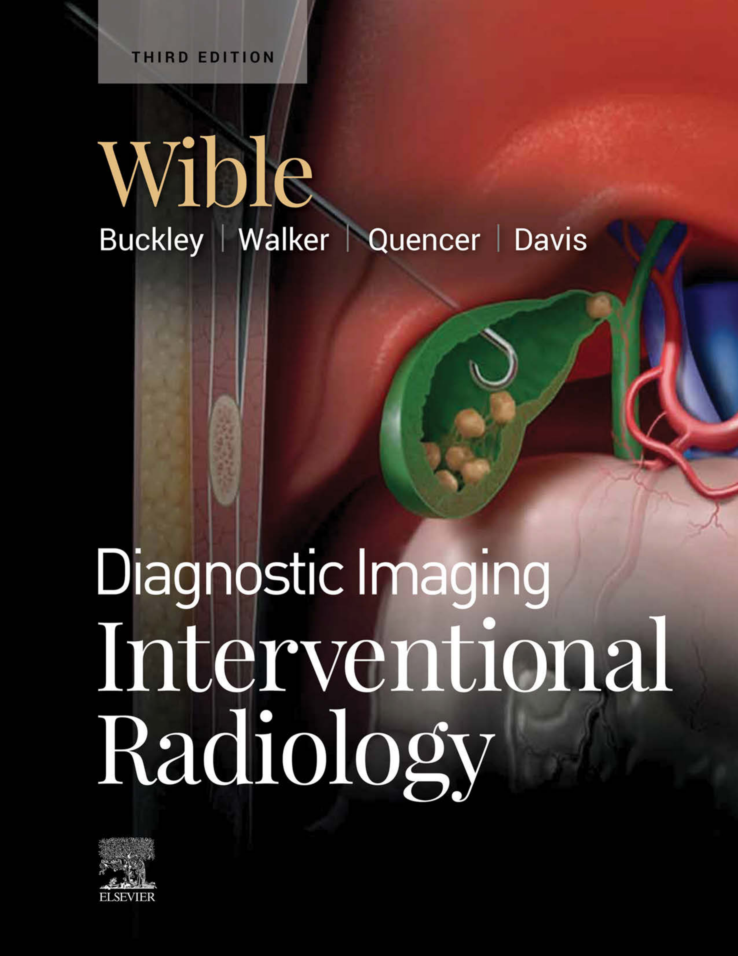 Diagnostic Imaging: Interventional Radiology E-Book