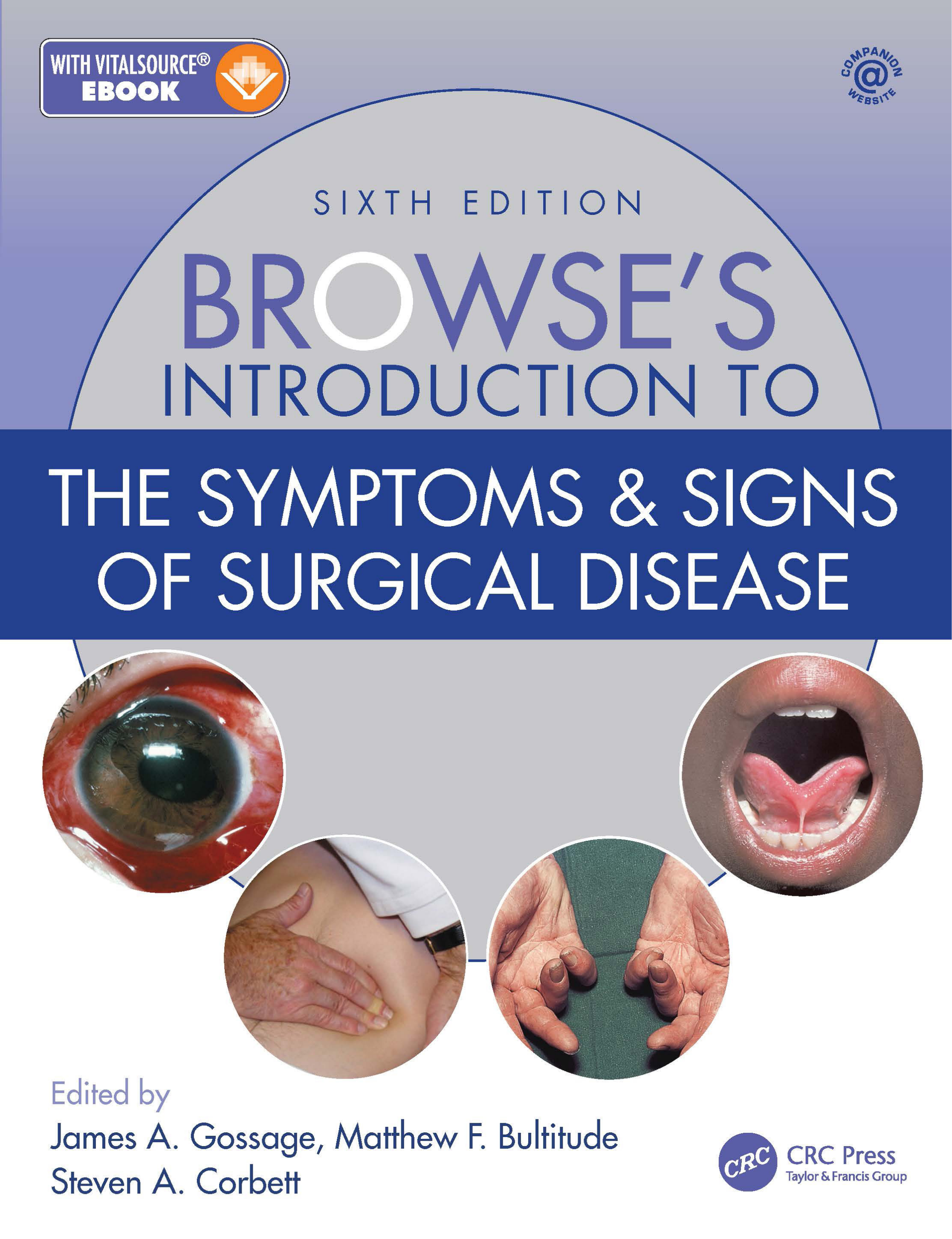 Browse's Introduction to the Symptoms and Signs of Surgical Disease