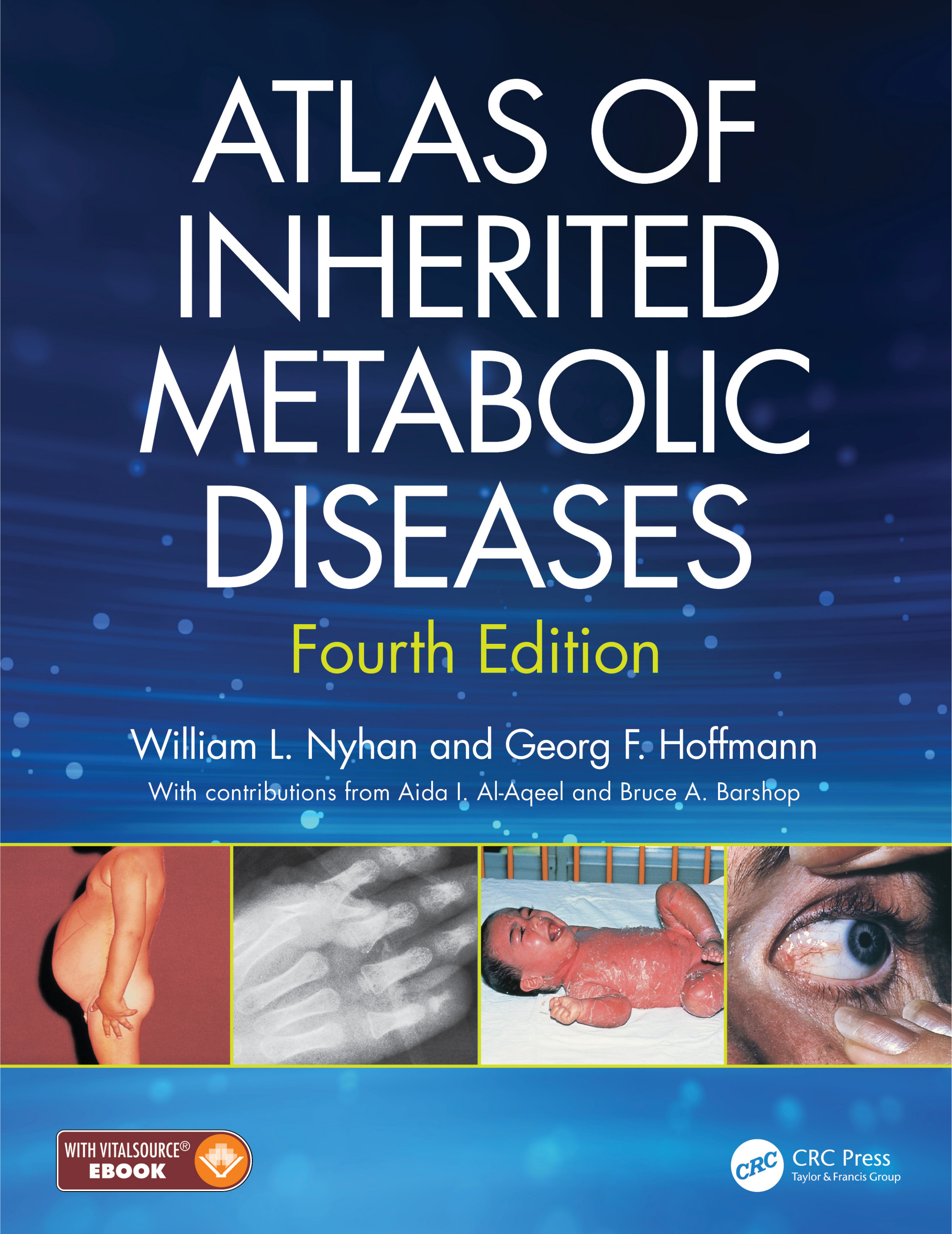 Atlas of Inherited Metabolic Diseases 3E