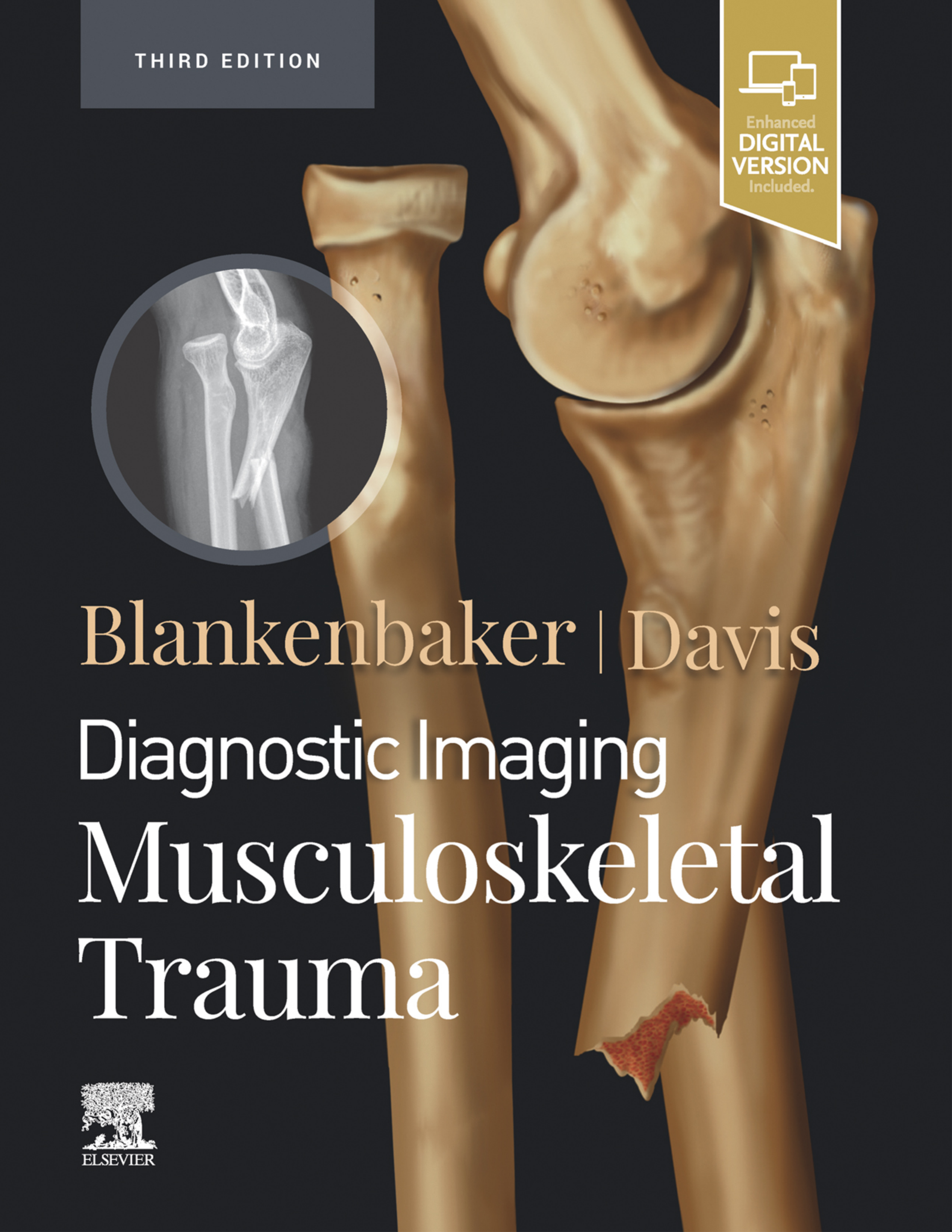 Diagnostic Imaging: Musculoskeletal Trauma E-Book