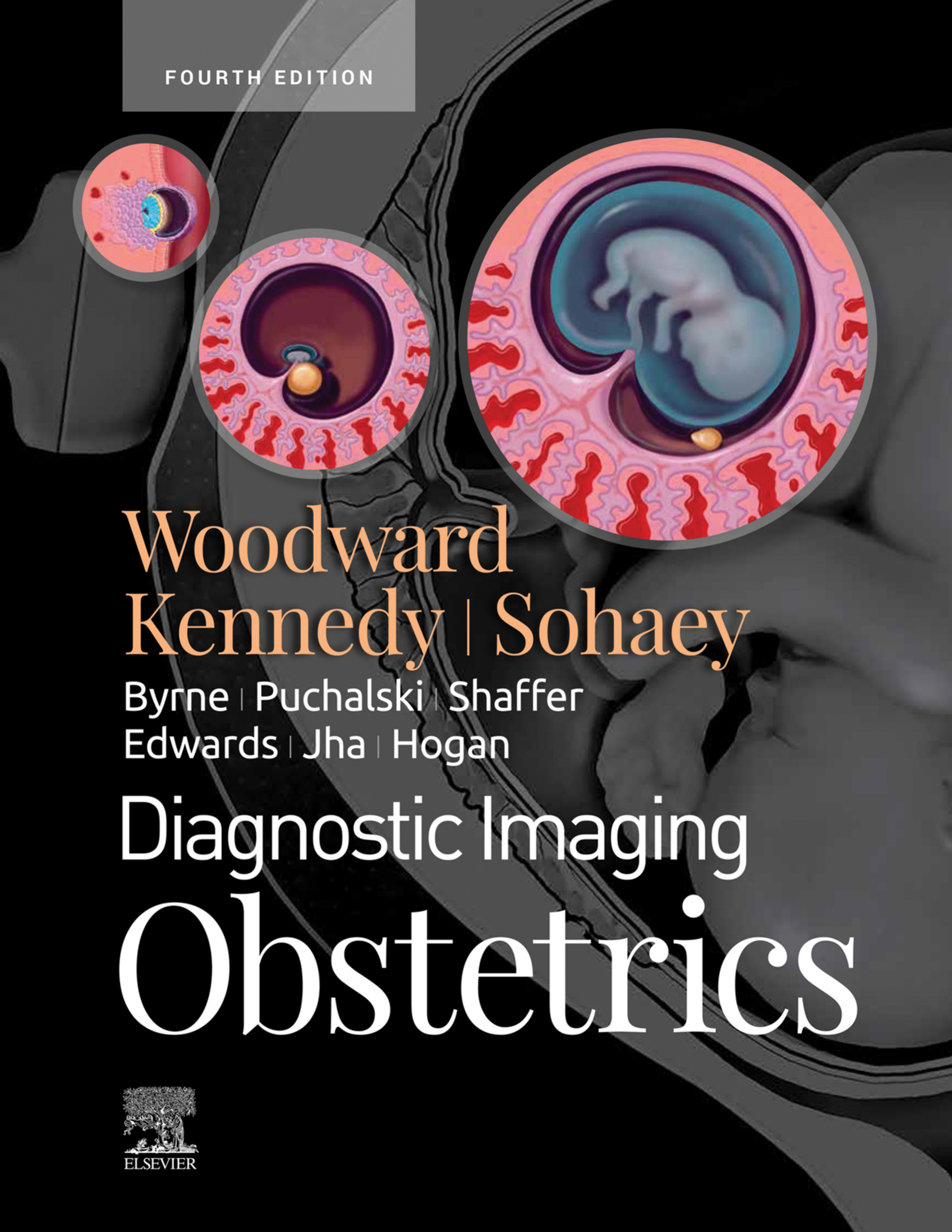 Diagnostic Imaging: Obstetrics E-Book