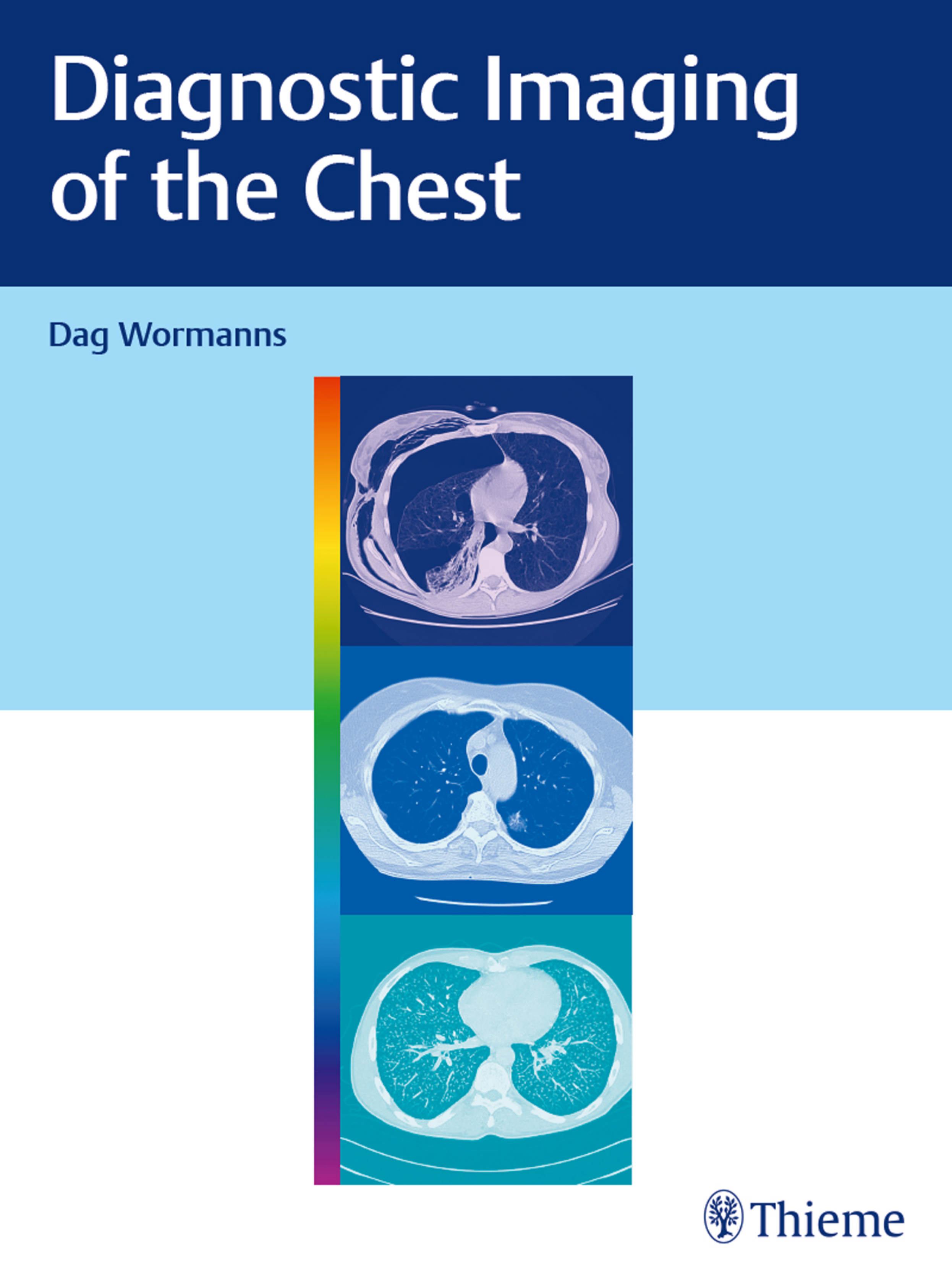 Diagnostic Imaging: Chest - E-Book