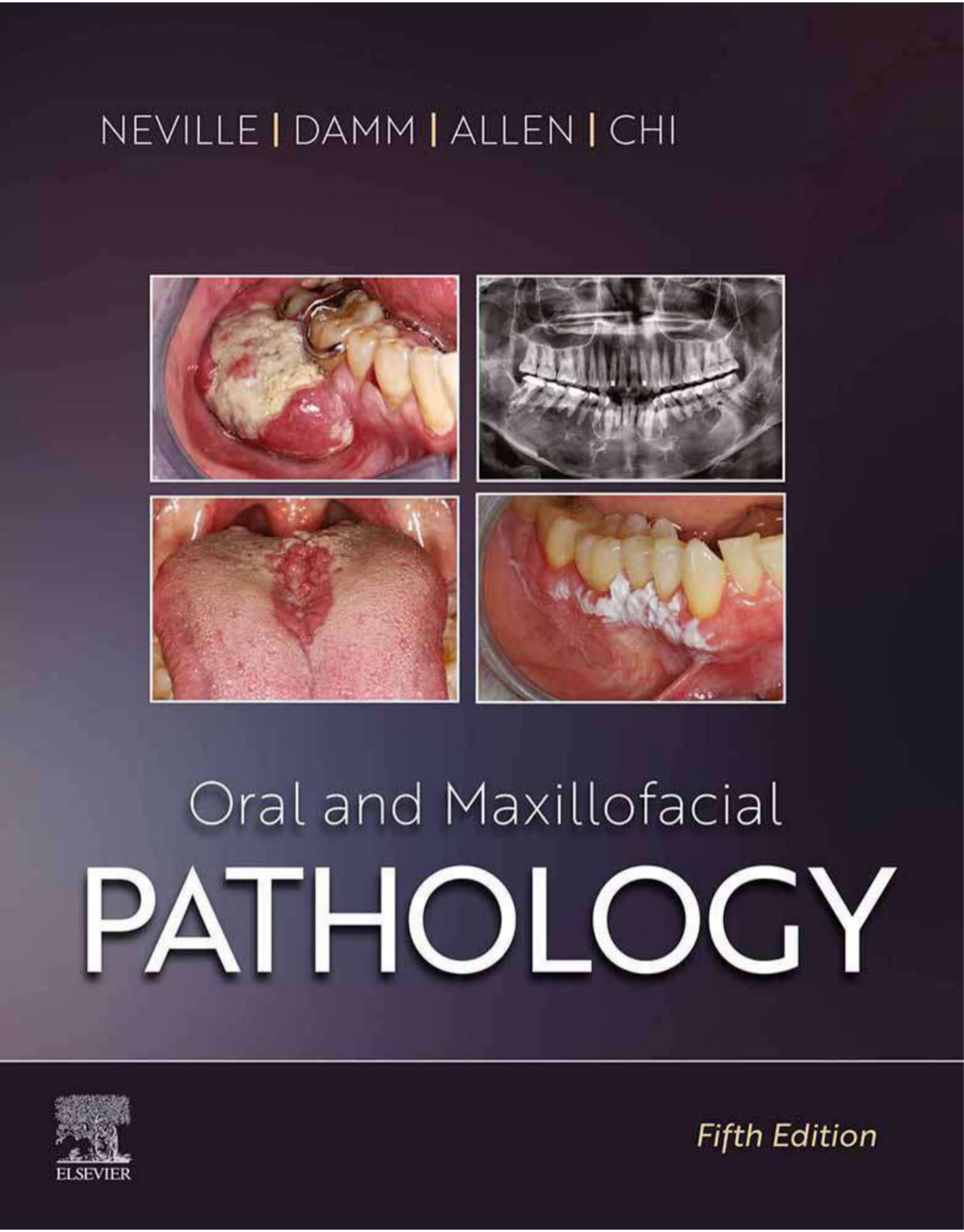 Oral and Maxillofacial Pathology - E-Book