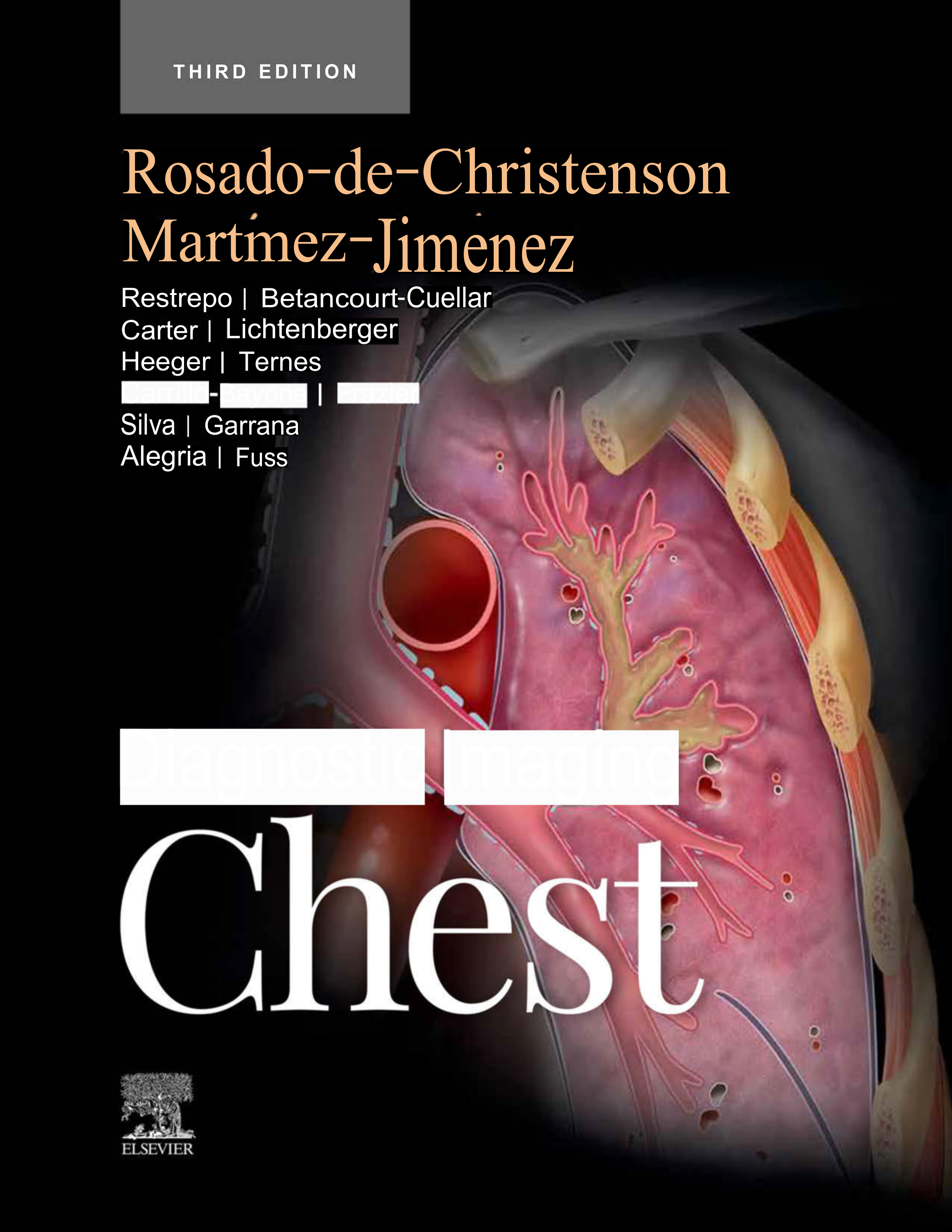 Diagnostic Imaging: Chest - E-Book