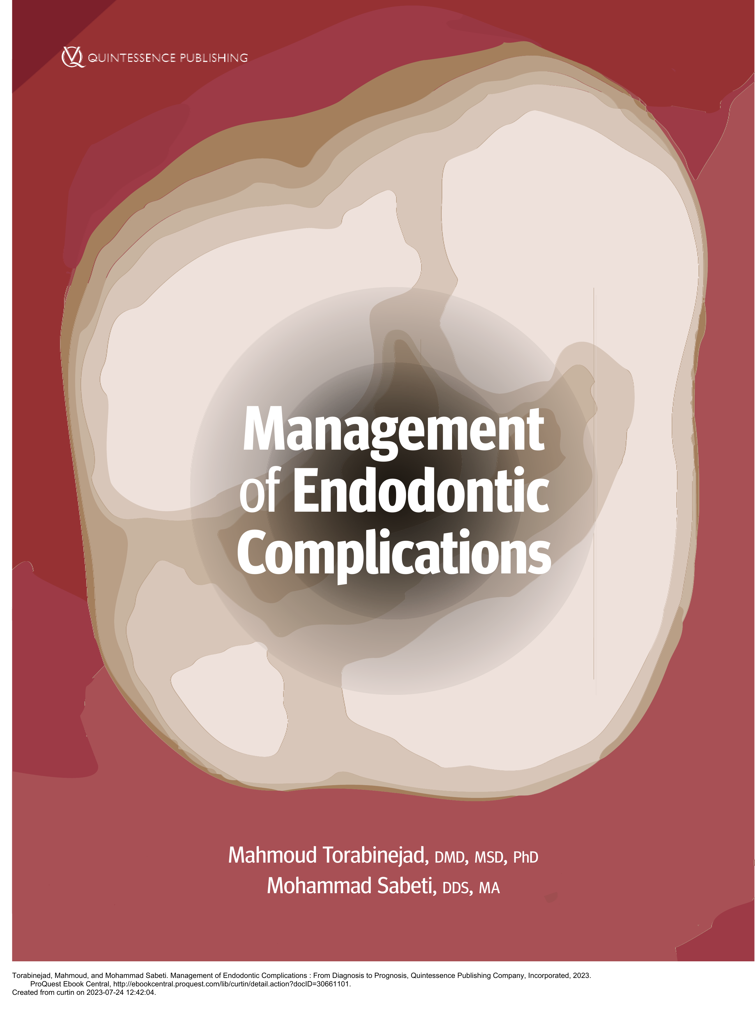 Management of Endodontic Complications