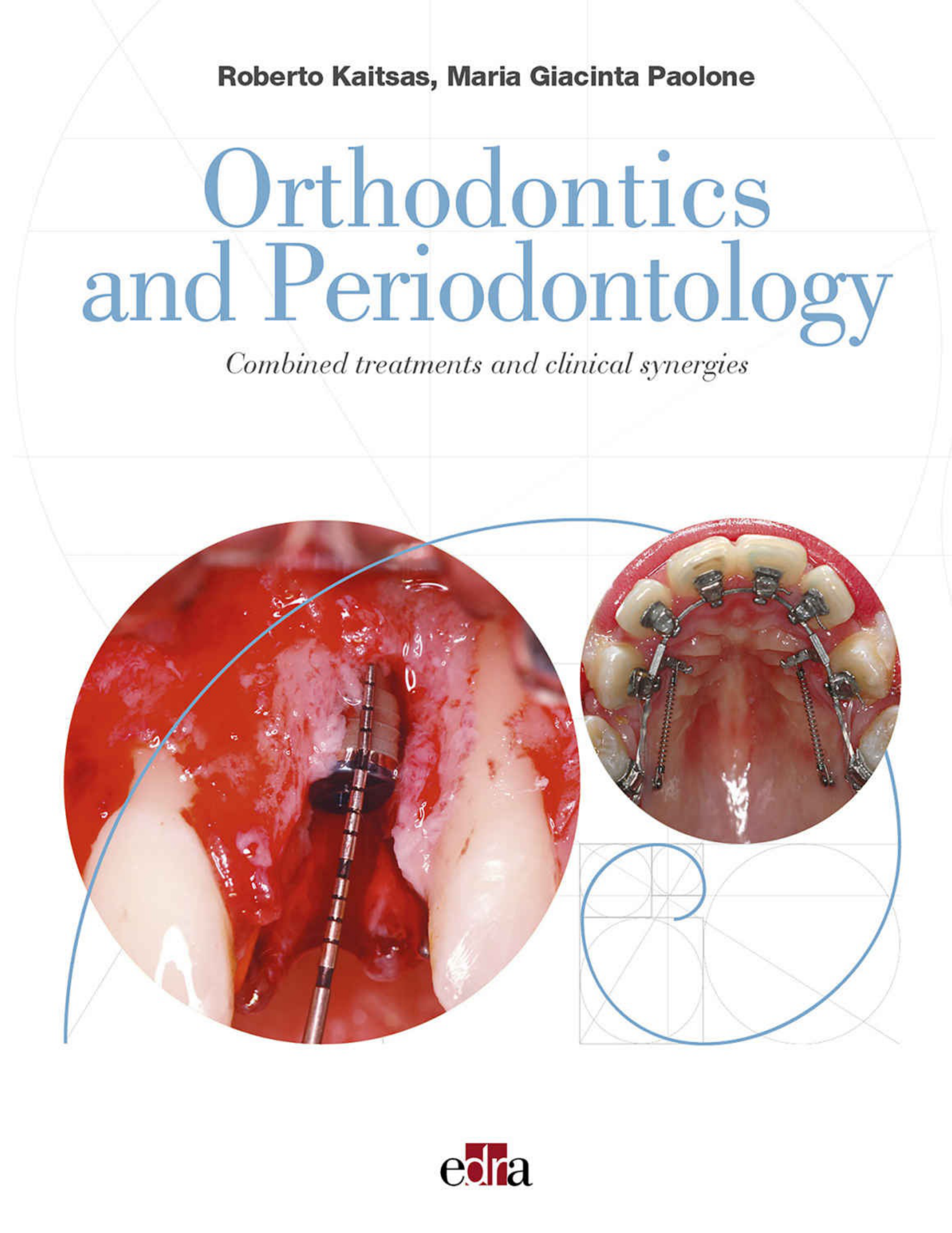 The Periodontium and Orthodontics in Health and Disease