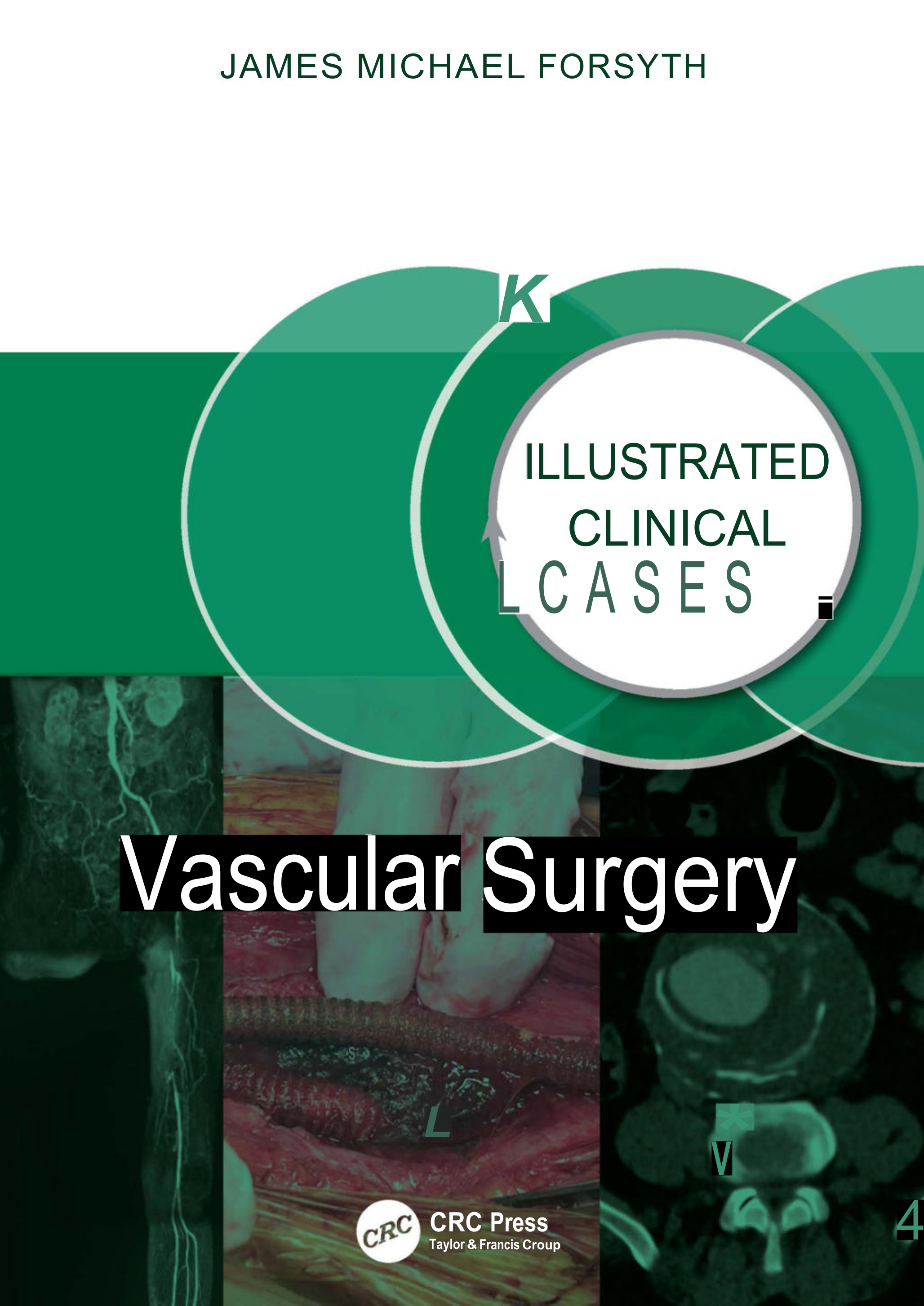 Vascular Surgery