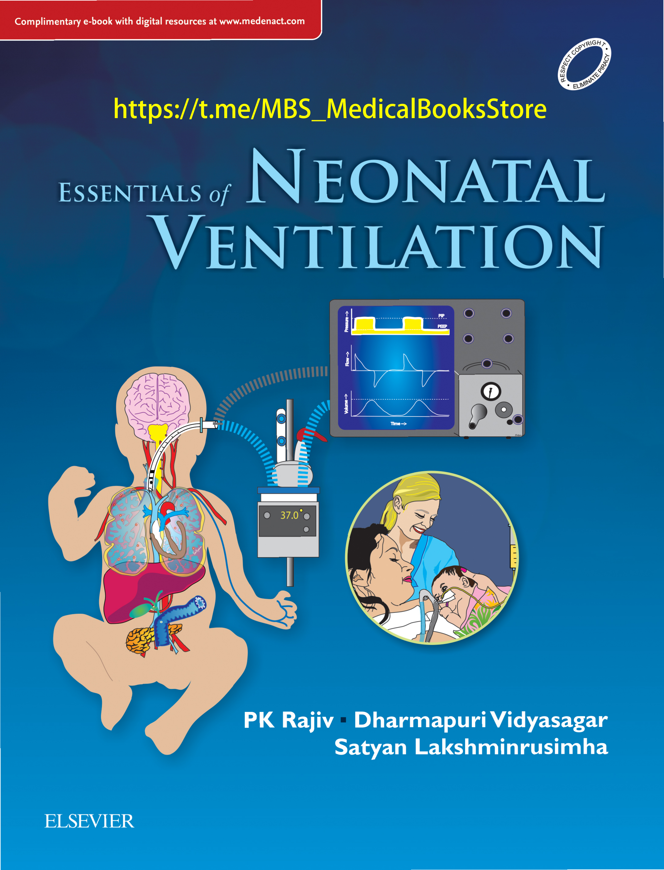 Essentials of Neonatal Ventilation, 1st edition, E-book