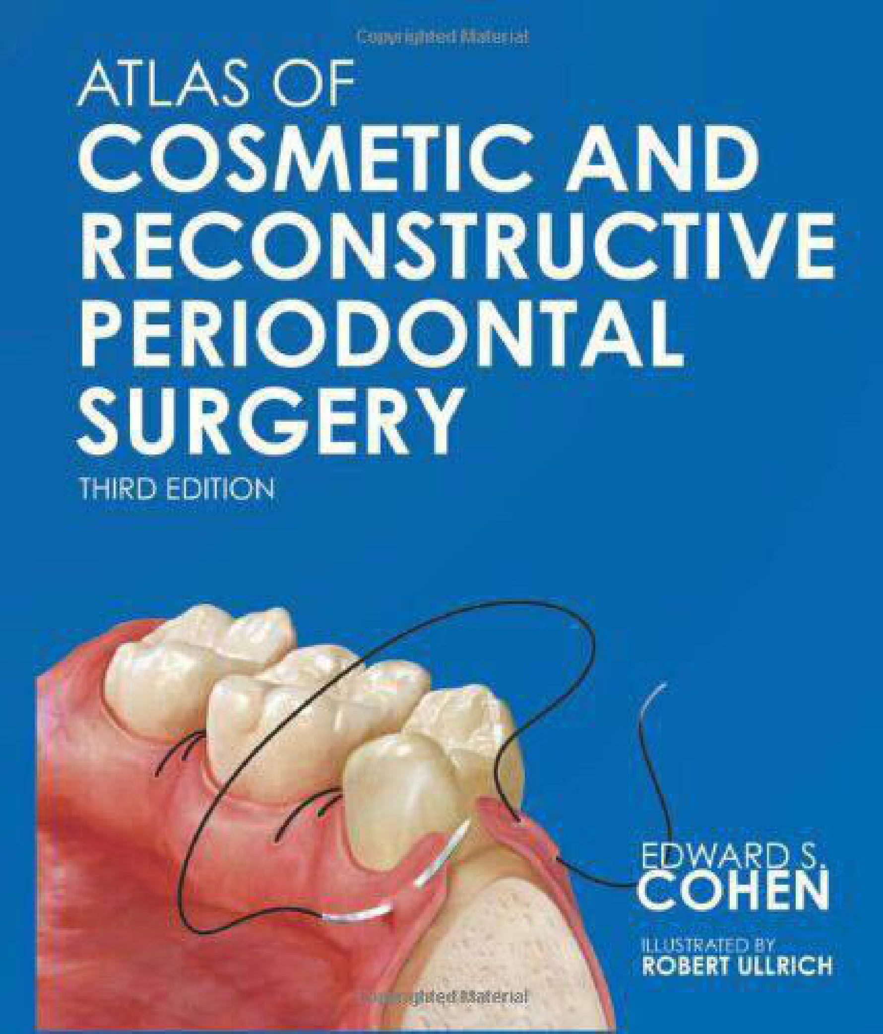 Atlas of Cosmetic and Reconstructive Periodontal Surgery